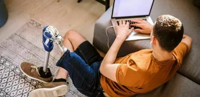 En mann med proteseben jobber på en laptop. Foto